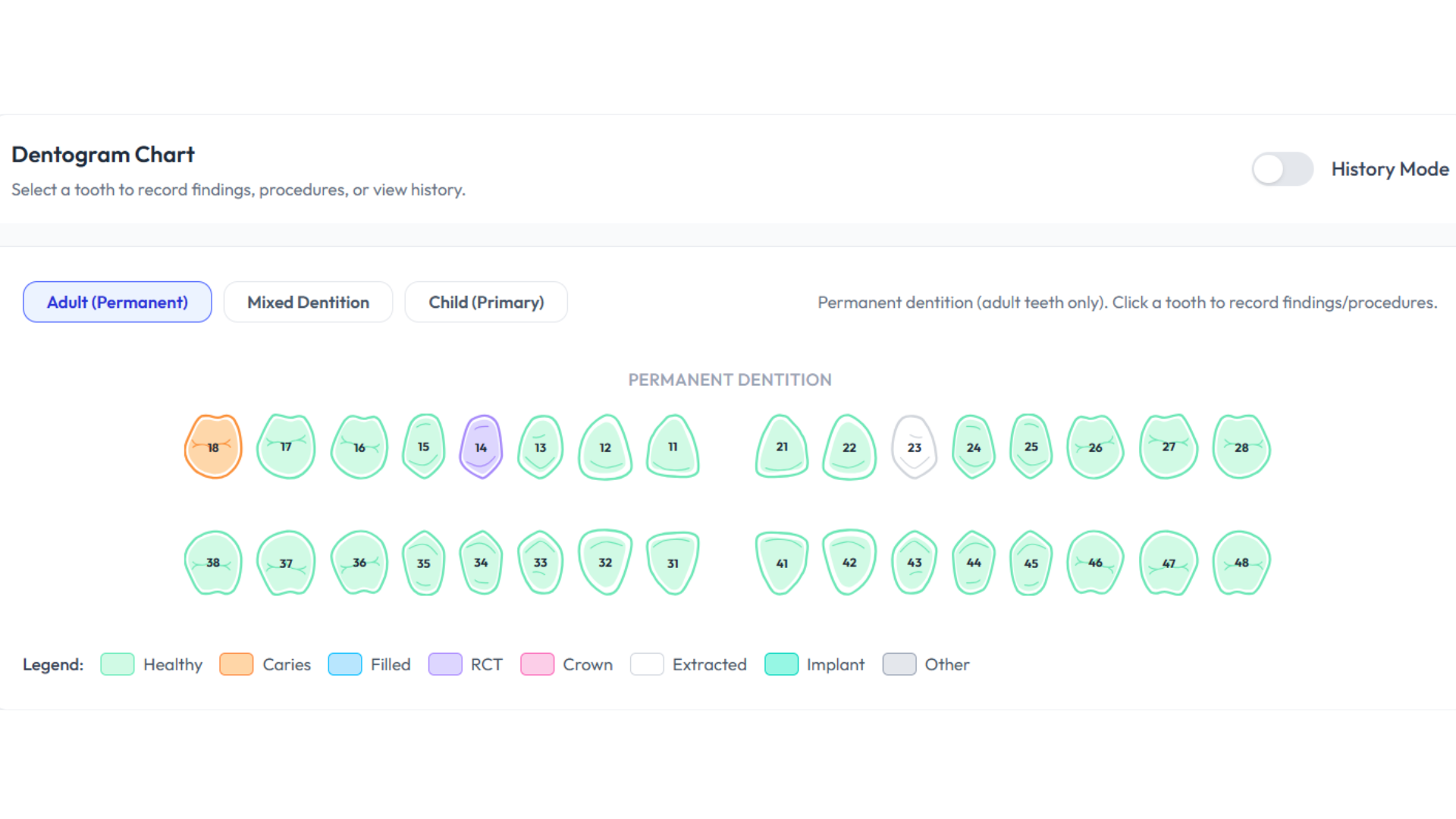 Interactive Dentogram